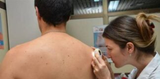 San Isidro: Consejos para protegerse del sol y prevenir el cáncer de piel